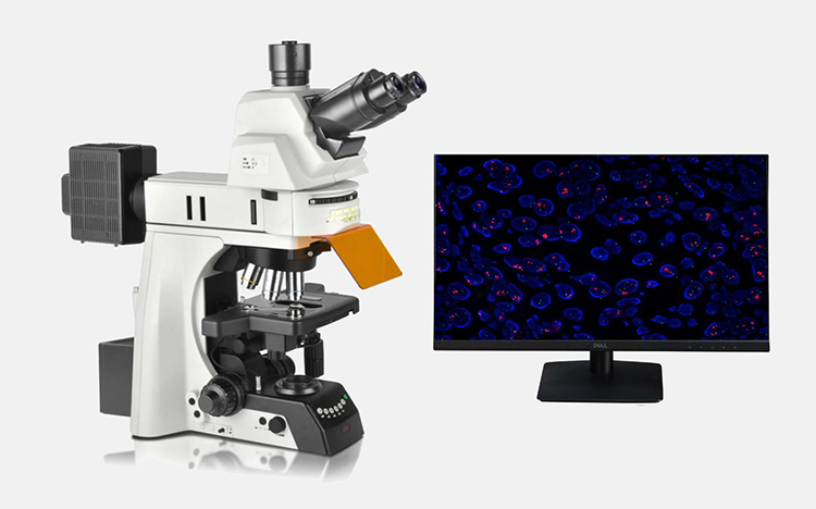 正置熒光顯微鏡、生物熒光顯微鏡、廣州明慧顯微鏡