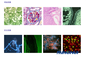 熒光顯微鏡解決方案特點-廣州市明慧科技有限公司