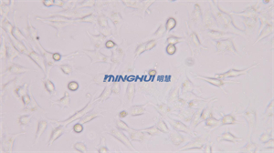 倒置生物顯微鏡MHIL150助力中山大學(xué)觀察精原細(xì)胞-廣州市明慧科技有限公司