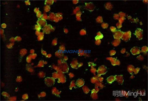 相差生物顯微鏡和熒光生物顯微鏡觀察支原體